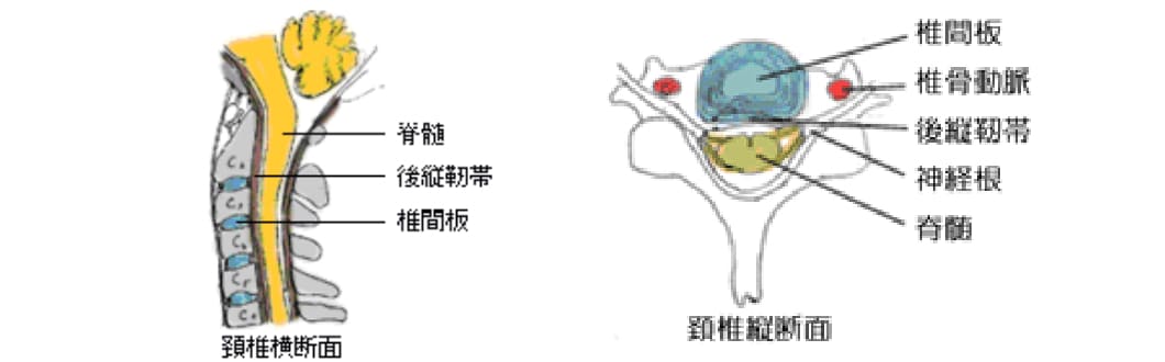 頚椎の代表的な疾患及び手術治療の解説